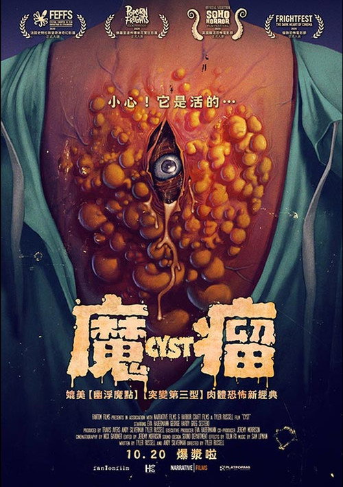 囊肿 海报